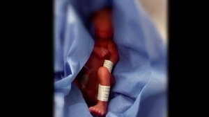 Confirmado: Encuentran bebé vivo en morgue del IMSS La Margarita